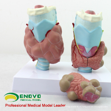 VISCERA13(12550) Medical Science Anatomical Thyroid Diseases Model with 4 parts